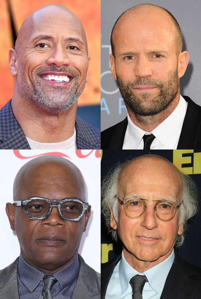 Celebrities with bald heads