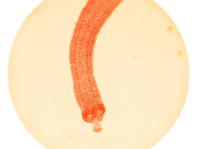 9. Tapeworms: 700 deaths a year